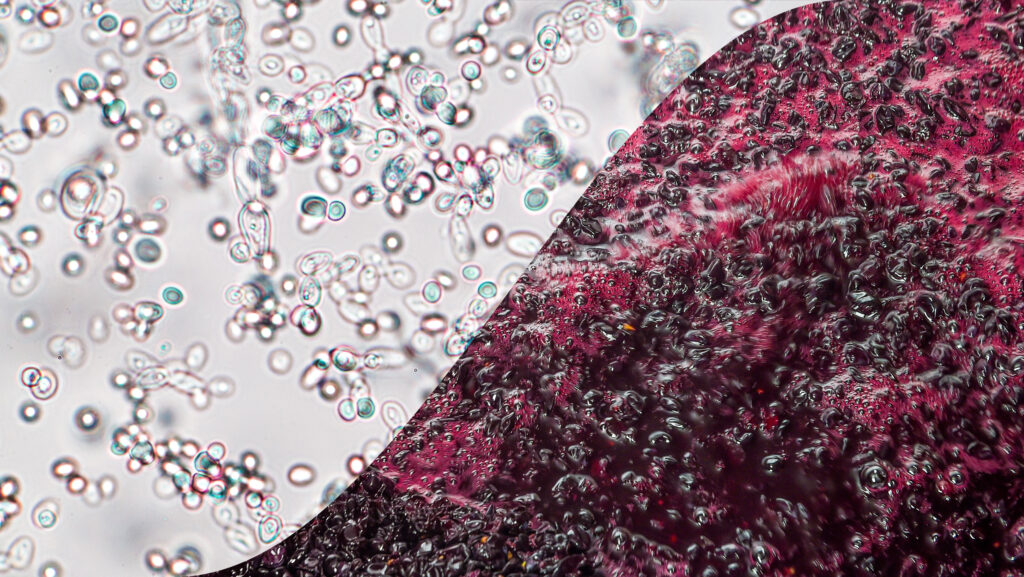 【葡萄酒知識】葡萄酒酵母：顯微鏡下的葡萄酒世界